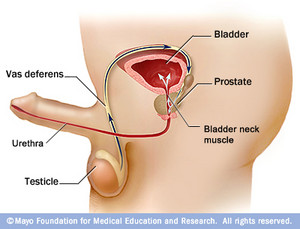 Prostate Cancer Symptoms – Benefits of Early Diagnosis